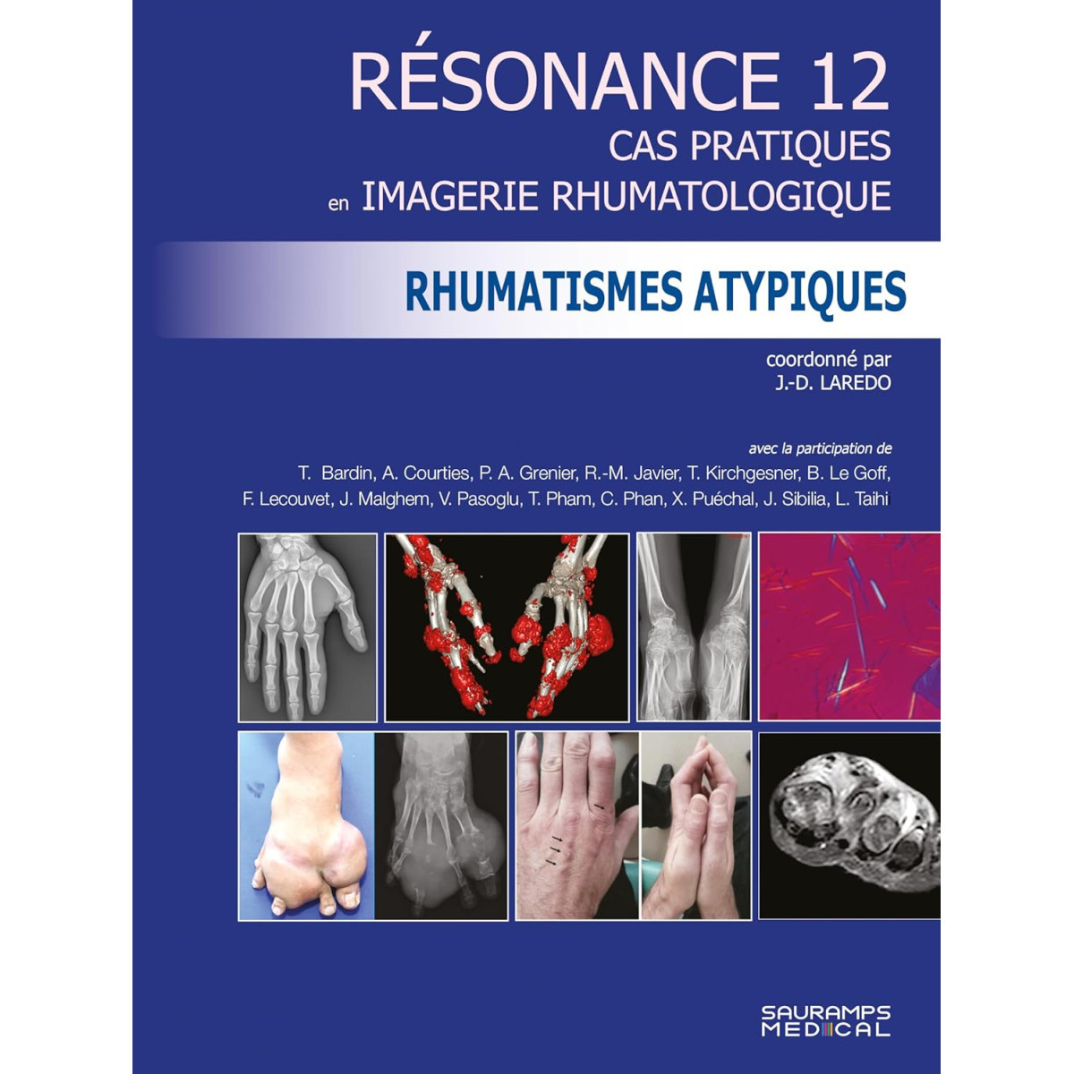 Résonance 12 - Cas pratiques en Imagerie rhumatologique : Rhumatismes atypiques