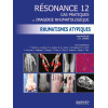Résonance 12 - Cas pratiques en Imagerie rhumatologique : Rhumatismes atypiques
