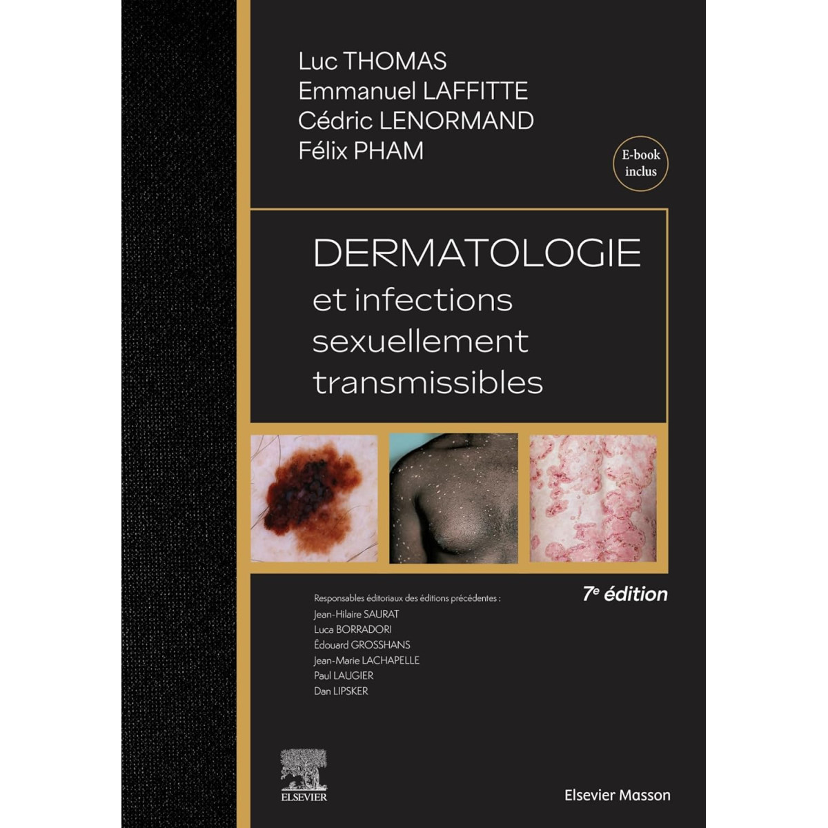 Dermatologie et infections sexuellement transmissibles