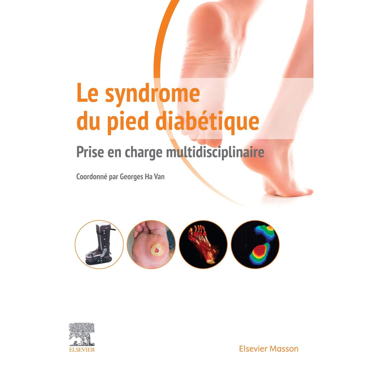 Le syndrome du pied diabétique - Prise en charge multidisciplinaire