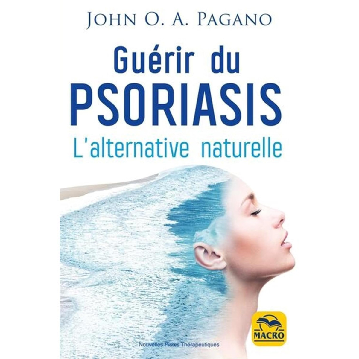 Guérir du psoriasis - L'alternative naturelle