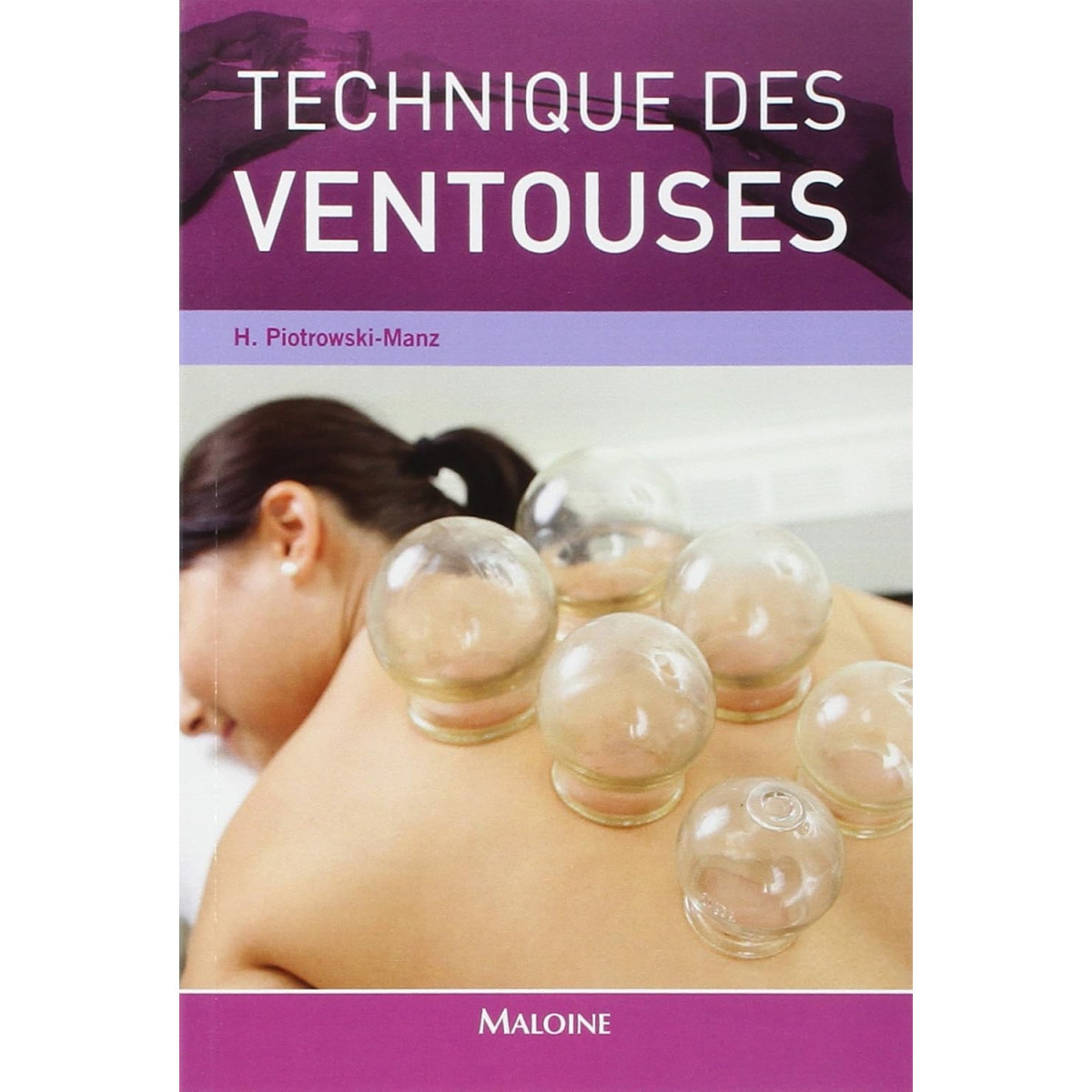 Technique des ventouses