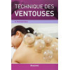 Technique des ventouses