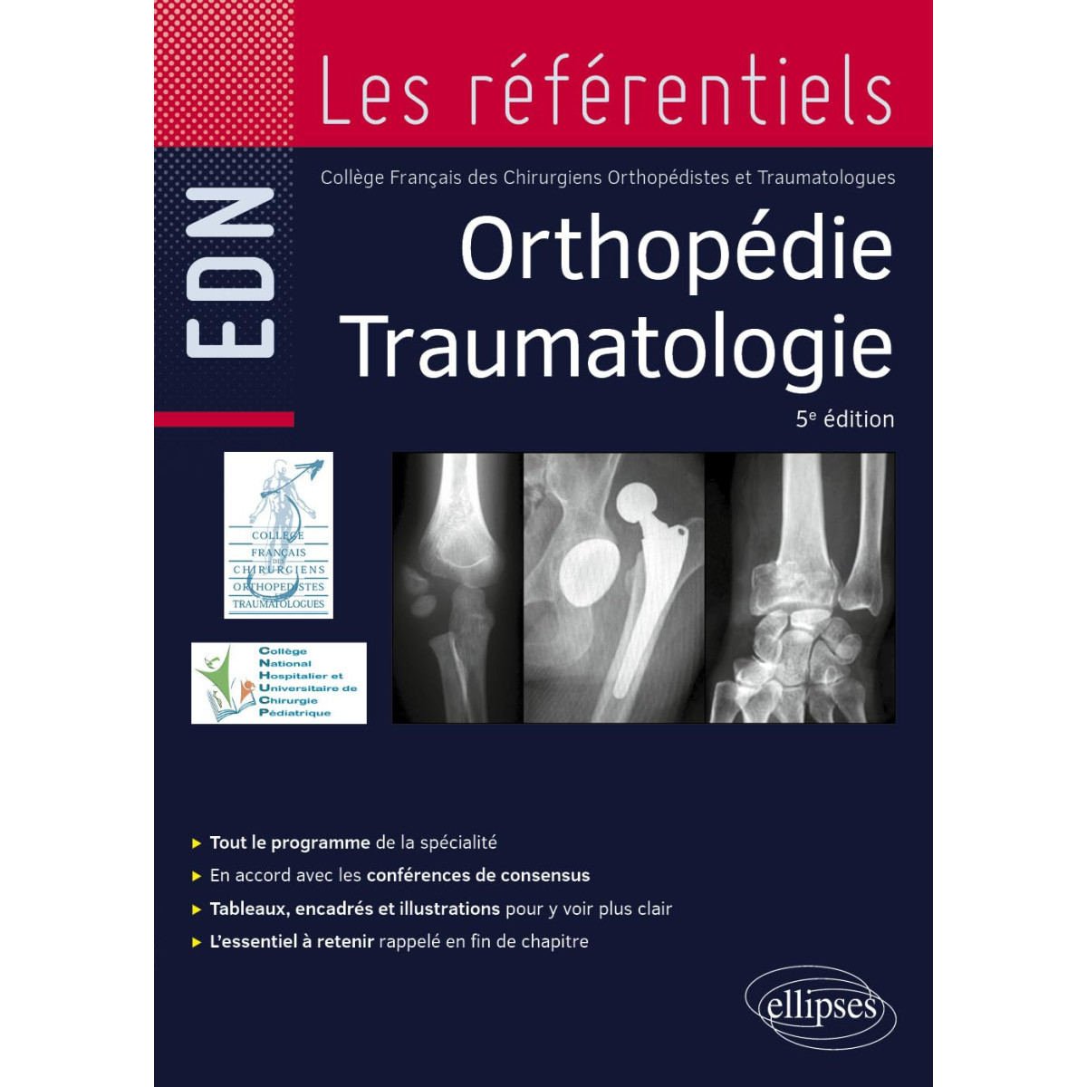 Collège Orthopédie Traumatologie 5e édition