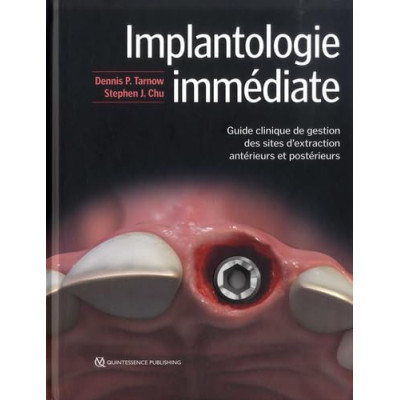Implantologie immédiate -...