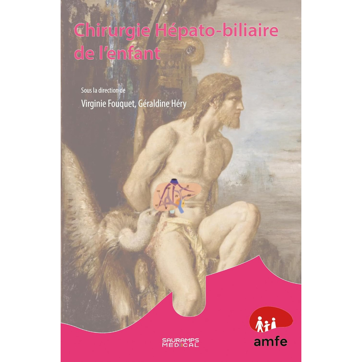 Chirurgie hépato-biliaire de l'enfant