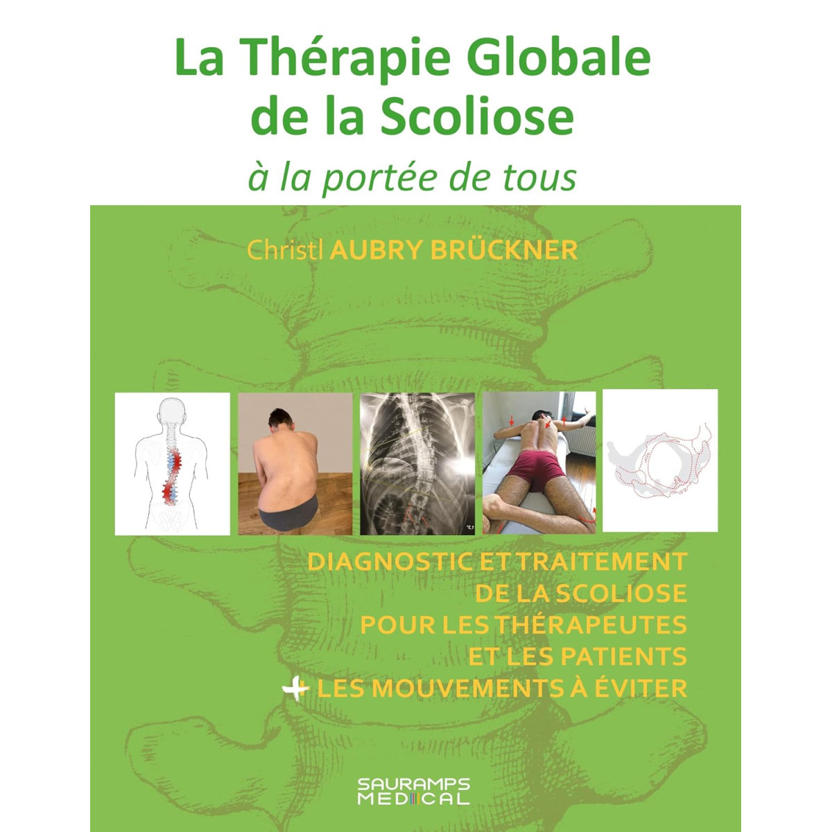 La Thérapie Globale de la Scoliose à la portée de tous
