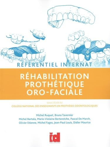 Référentiel Internat - Réhabilitation prothétique oro-faciale