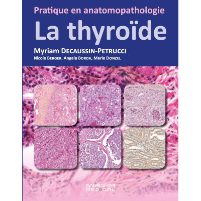 La thyroïde