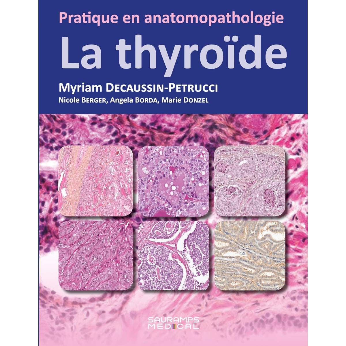 La thyroïde