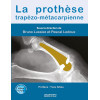 La prothèse trapézo-métacarpienne