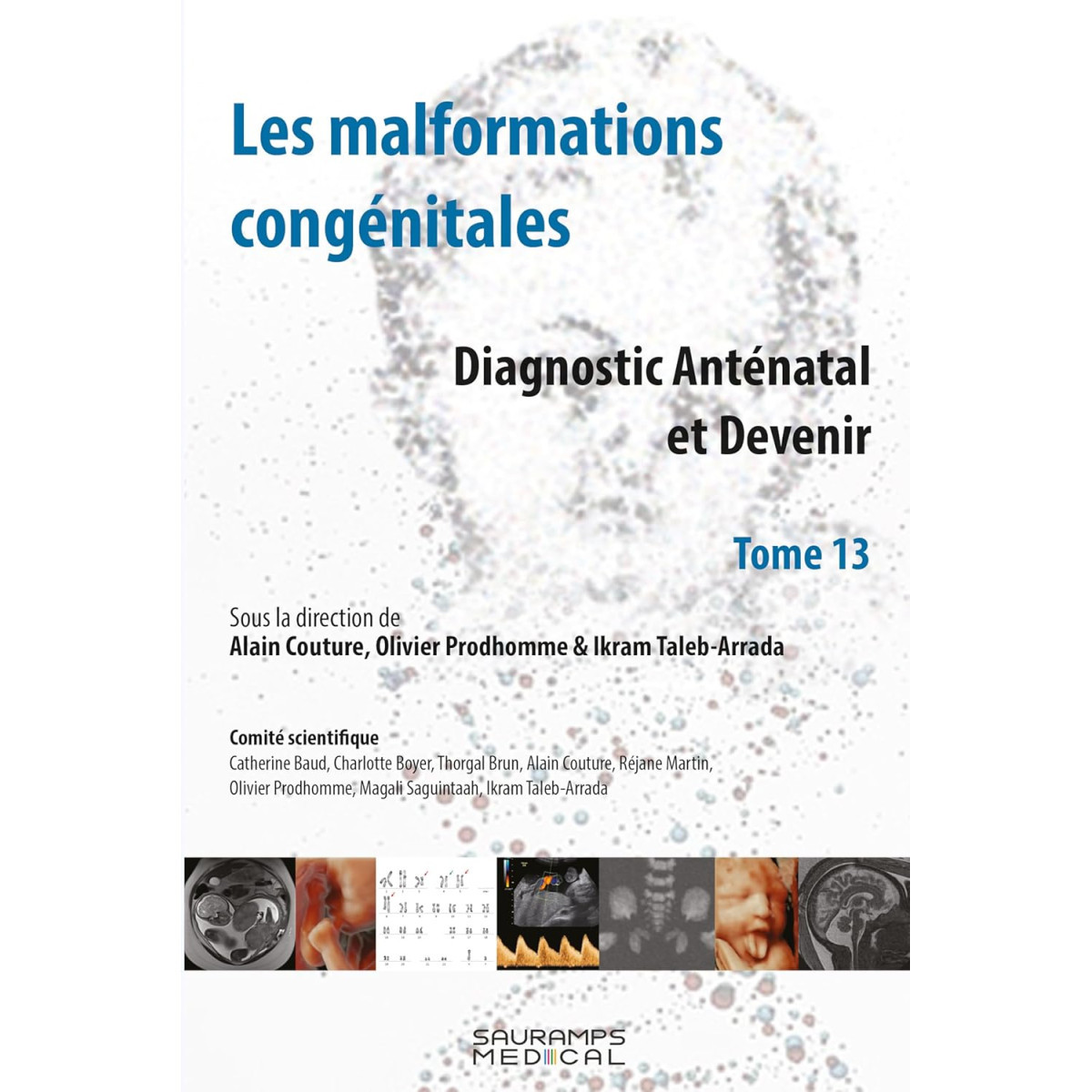 Les malformations congénitales - Diagnostic anténatal et Devenir Tome 13
