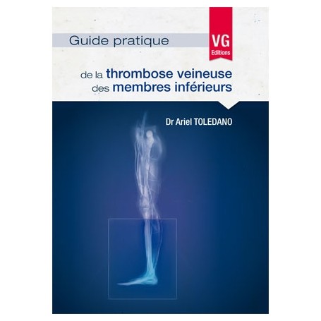 Guide pratique de la thrombose veineuse des membres inférieurs