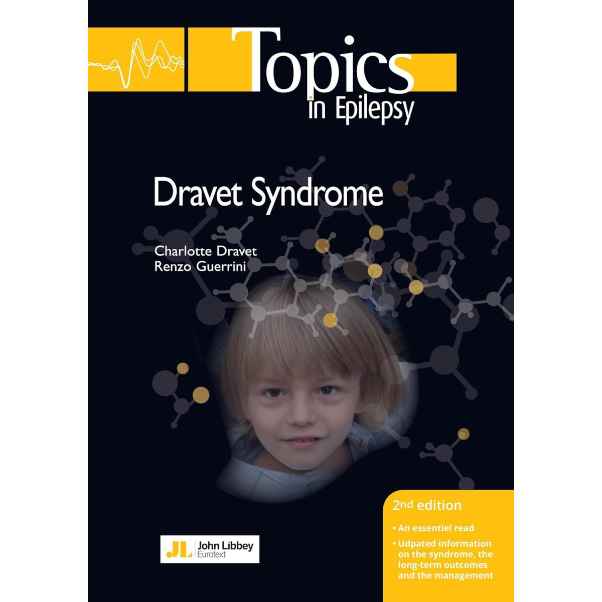 Dravet Syndrome 2e édition - Édition en Anglais