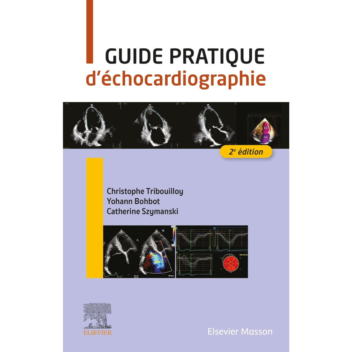 Guide pratique d'échocardiographie 2e édition