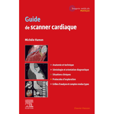 Guide de scanner cardiaque