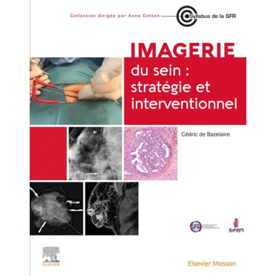 Imagerie du sein -...