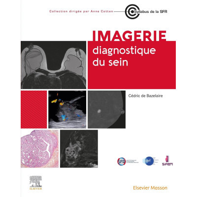 Imagerie diagnostique du sein