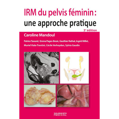 IRM du pelvis féminin -...