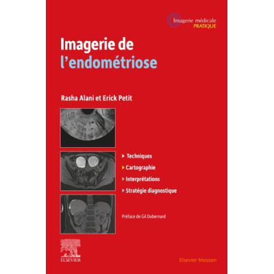 Imagerie de l'endométriose