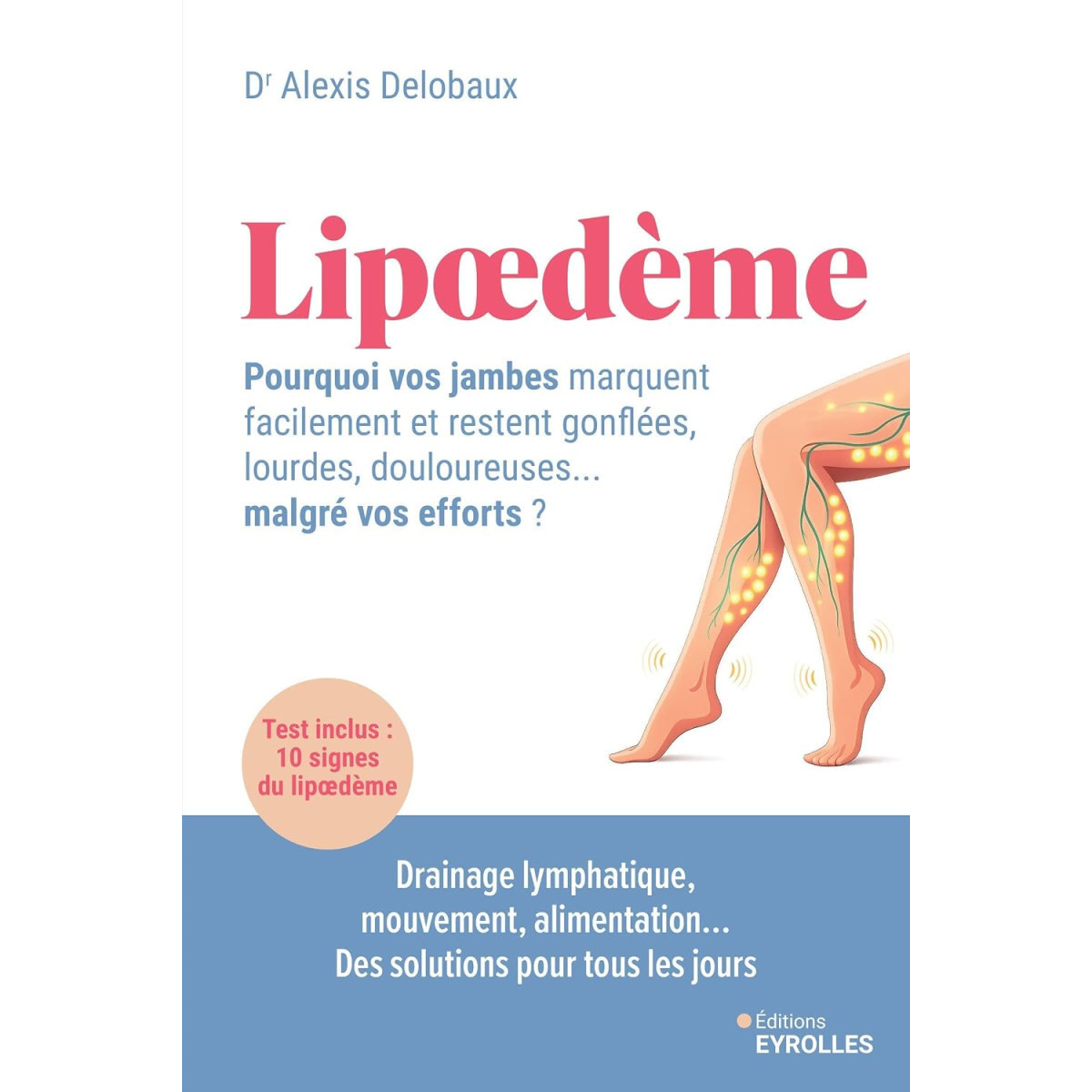 Lipœdème - Pourquoi vos jambes marquent facilement et restent gonflées, lourdes, douloureuses... malgré vos efforts ?