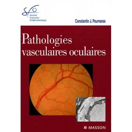Pathologies vasculaires oculaires - Rapport SFO 2008