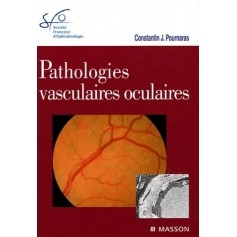Pathologies vasculaires oculaires