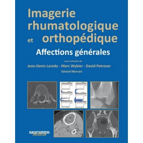 Imagerie rhumatologique et orthopédique, tome 1