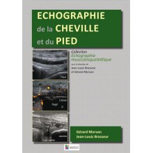 Echographie de la cheville...