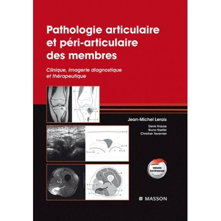 Pathologie articulaire et péri-articulaire des membres