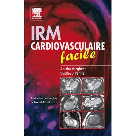 IRM cardiovasculaire facile