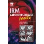 IRM cardiovasculaire facile