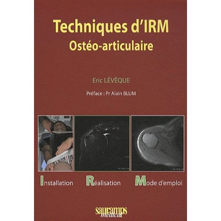 Techniques d'IRM ostéo-articulaire