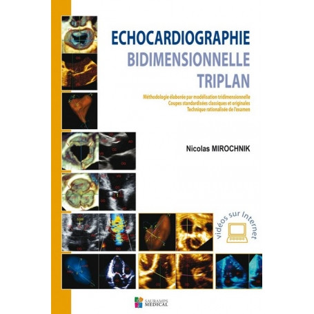 Echocardiographie bidimensionnelle triplan