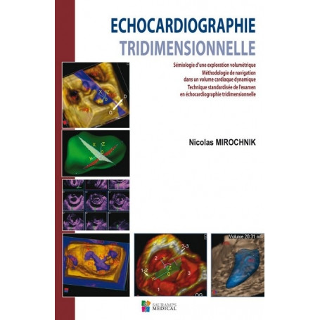 Echocardiographie tridimensionnelle