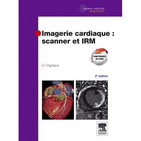 Imagerie cardiaque : scanner et IRM