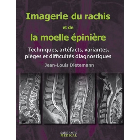 Imagerie du rachis et de la moelle épinière