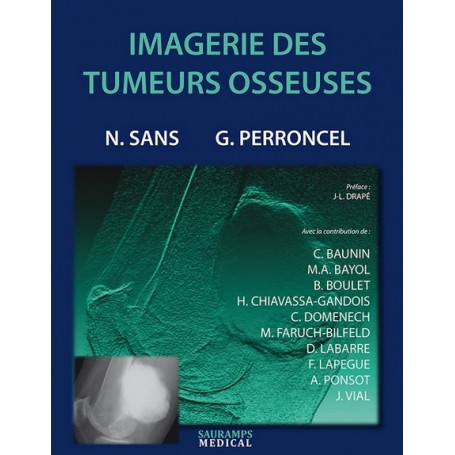 Imagerie des tumeurs osseuses