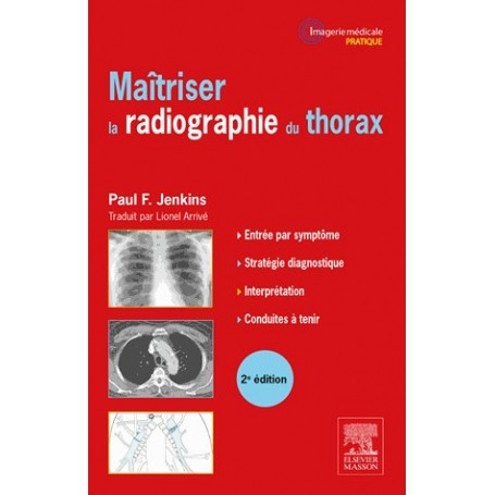 Maîtriser la radiographie du thorax