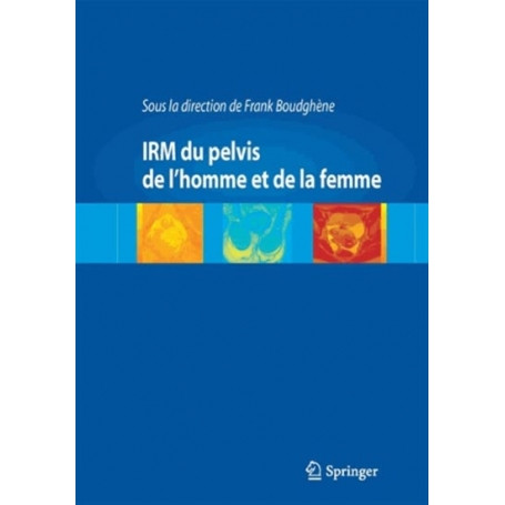 IRM du pelvis de l'homme et de la femme