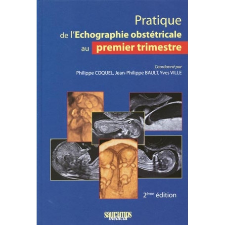 Pratique de l'échographie obstétricale au premier trimestre