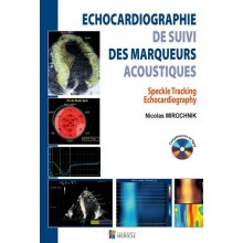 Echocardiographie de suivi...