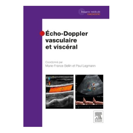 Echo-doppler vasculaire et viscéral