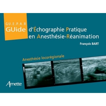 Guide d'échographie pratique en anesthésie-réanimation