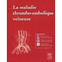 La maladie thrombo-embolique veineuse