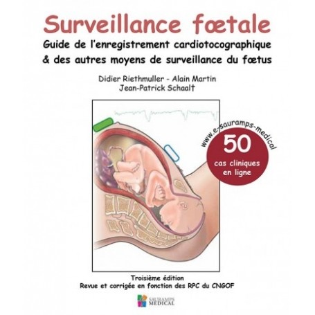 Surveillance fœtale