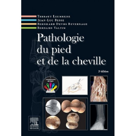 Pathologie du pied et de la cheville