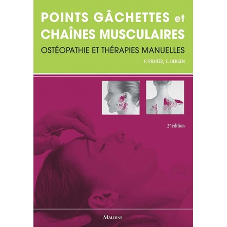 Points gâchettes et chaînes musculaires