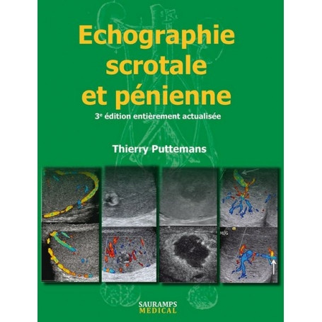 Echographie scrotale et pénienne