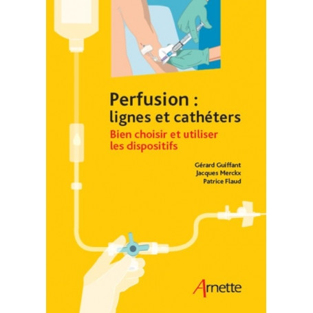 Perfusion : lignes et cathéters - Bien choisir et utiliser les dispositifs